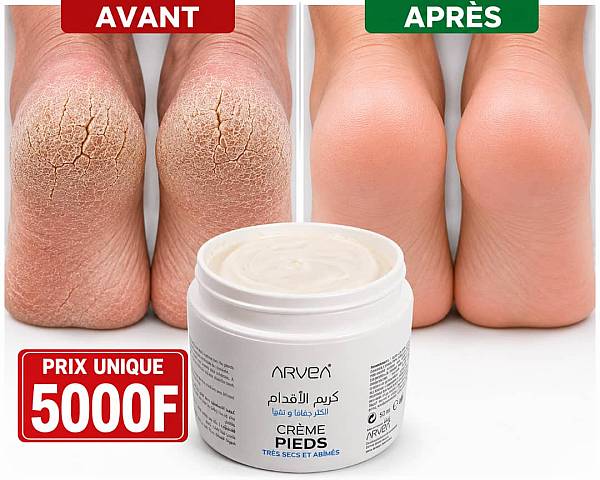 Promotion sur Adieu aux pieds secs