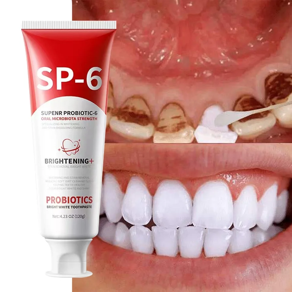 Pâte dentifrice blanchissant SP6
