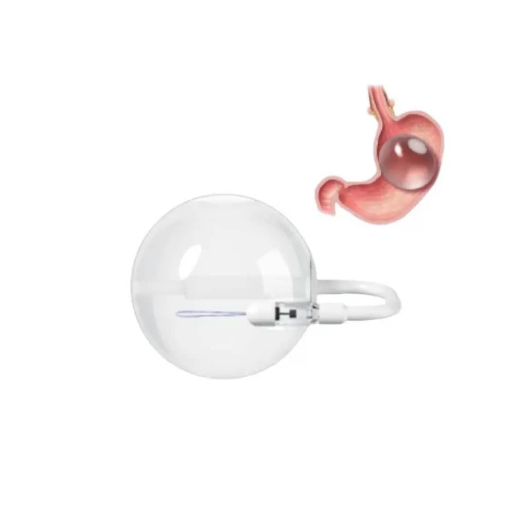 Ballon gastrique