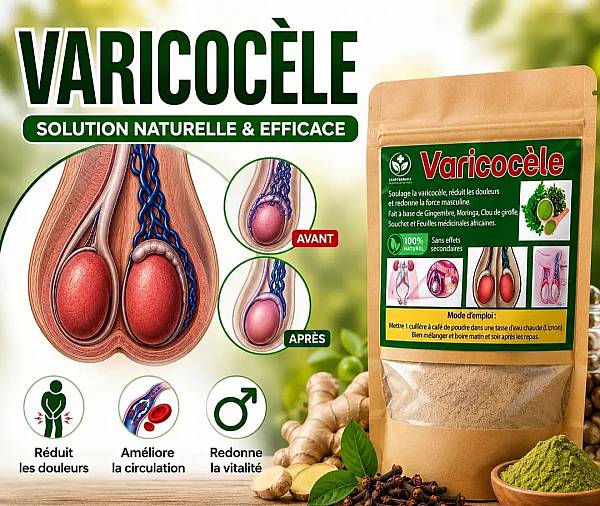 VARICOCÈLE